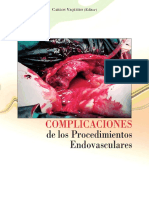 Complicaciones: de Los Procedimientos Endovasculares