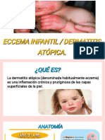Eccema Infantil / Dermatitis Atópica. Eccema Infantil / Dermatitis Atópica. Eccema Infantil / Dermatitis Atópica