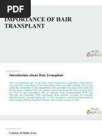 Importance of Hair Transplant