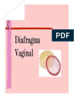 Diafragma Diafragma Diafragma Diafragma Vaginal Vaginal Vaginal Vaginal Vaginal Vaginal Vaginal Vaginal