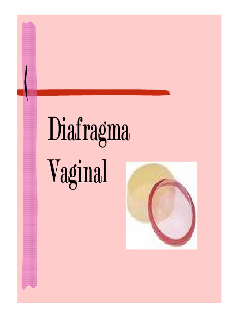 Diafragma Diafragma Diafragma Diafragma Vaginal Vaginal Vaginal Vaginal ...