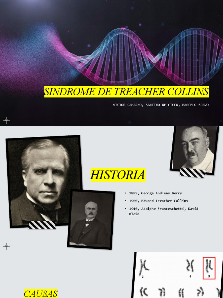 Treacher Collins Presentacion | PDF