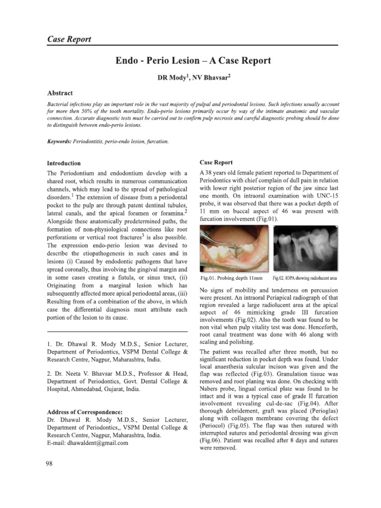 (Bangladesh Journal of Dental Research & Education 2014Aug 31 Vol. 4