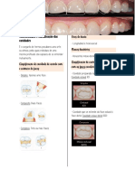 Classificação de cavidades dentárias