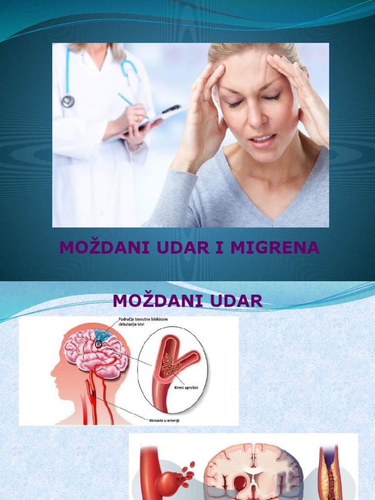 Mozdani Udar I Migrena Pdf