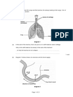 Diagram Shows Lungs, Trachea and Alveolus Structure