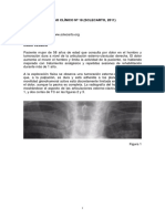 Caso Clínico de Artroisis de Hombro - Ejemplo