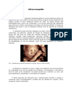 Ultrassonografia: Fig. 1: Ultrassom Pré-Natal 3D Mostrando A Cabeça, Bracos e Mãos Do Bebê