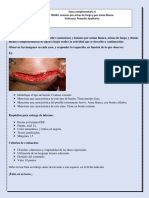 Tarea Complementaria II. TEMAS: Lesiones Por Armas de Fuego y Por Armas Blanca. Profesora: Práxedes Apolinario