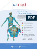 12 Lead ECG Placement Guide