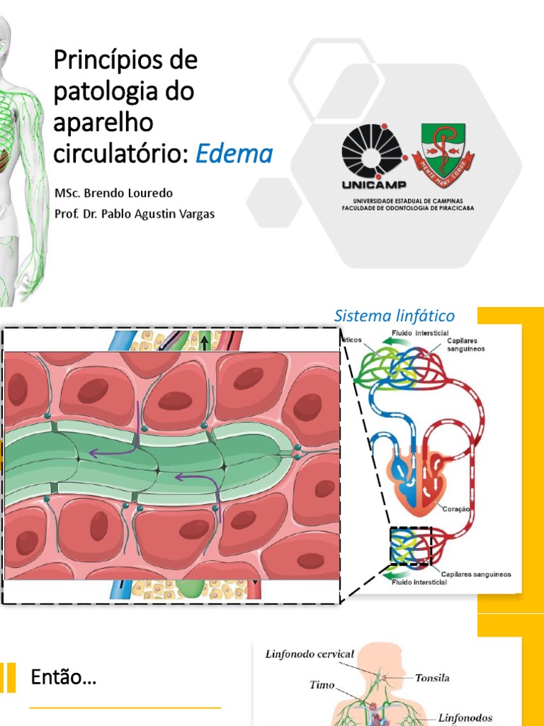 Slides Edema | PDF | Edema | Sistema linfático