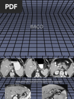 Download Bao by Web Midia SN63644284 doc pdf