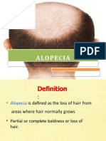 Alopecia 160716052003