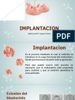 Implantacion: Valeria Lizeth Campos Torres