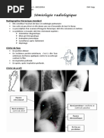 Signe de la silhouette en radiologie | PDF | Aorte | Thorax