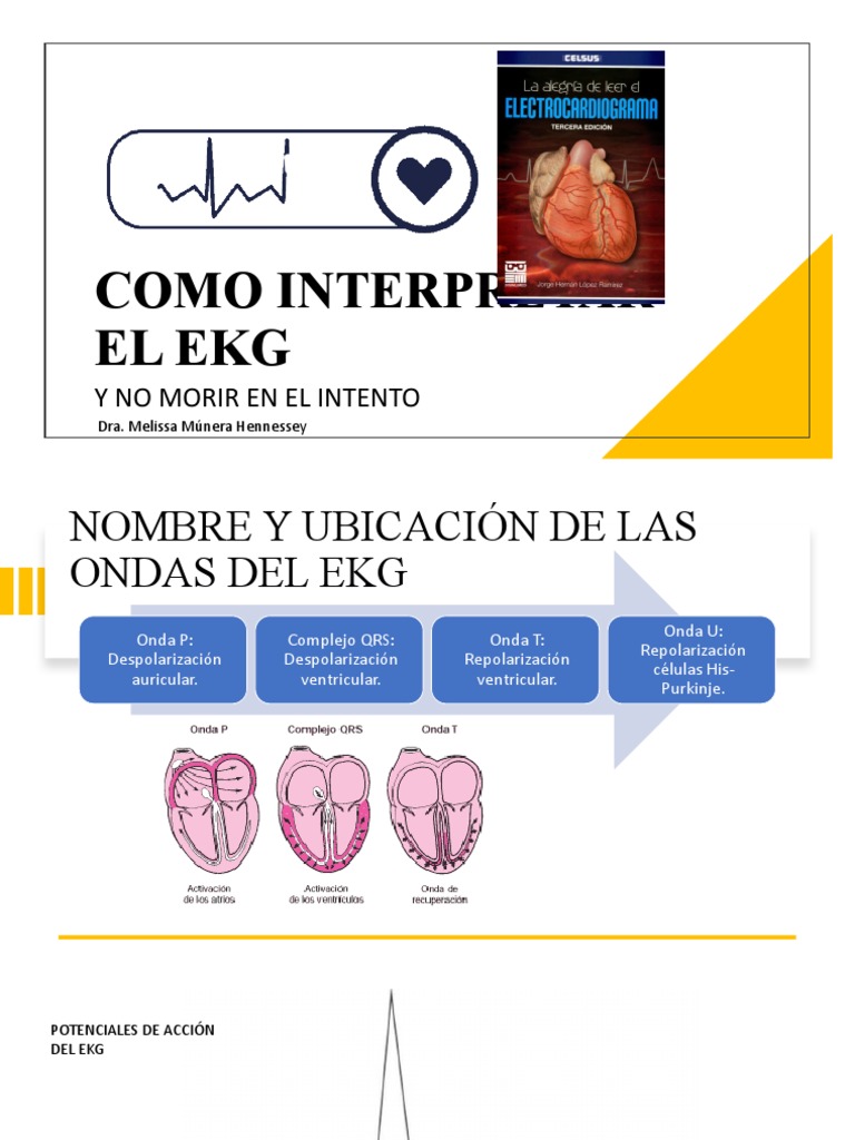 COMO INTERPRETAR EL EKG y No Morir en El Intento. | PDF ...