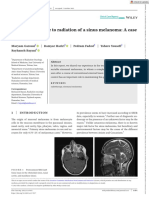 Clinical Case Reports - 2023 - Garousi - Dramatic Response To Radiation of A Sinus Melanoma A Case Report