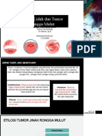 Referat Karsinoma Rongga Mulut Meli