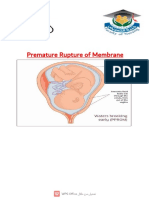 Premature Rupture of Membrane