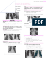 Representação radiológica dos pulmões