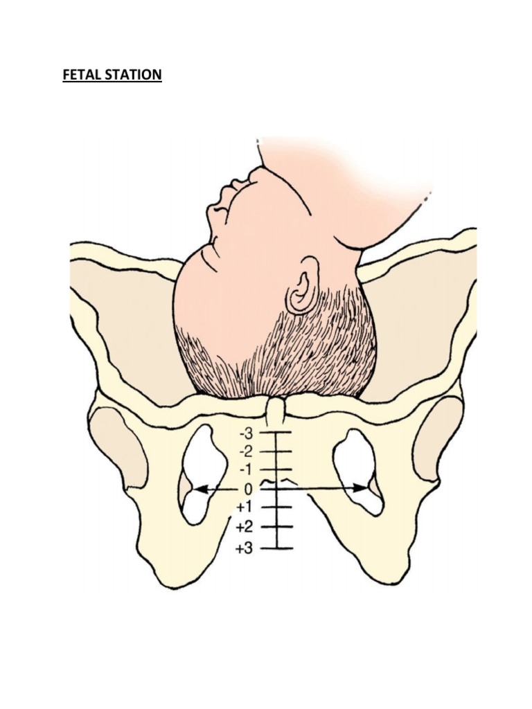Fetal Station PDF