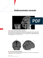 Collège Imagerie - Radioanatomie Normale en Neurologie