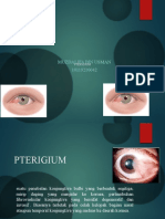Ptirigium