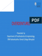 Overdentures: Presented by Department of Prosthodontics & Implantology, SRM Kattankulathur Dental College &hospital