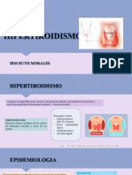 Causas y manifestaciones del hipertiroidismo