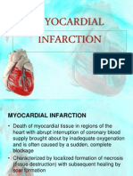 Myocardial Infarction Causes, Symptoms, Treatment