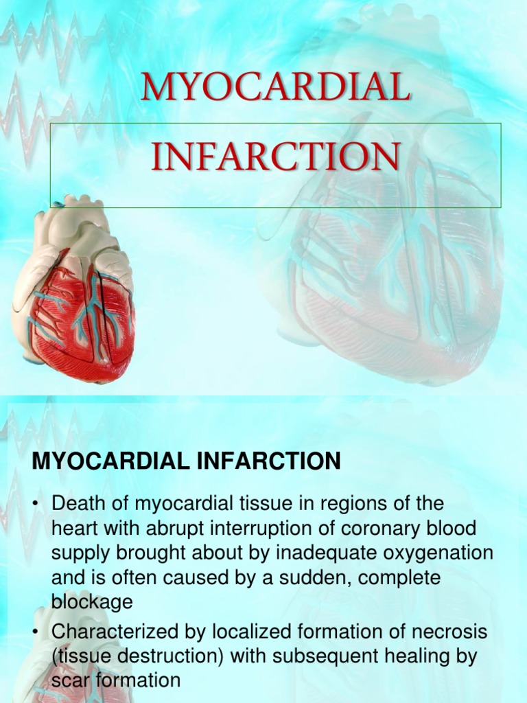 Myocardial Infarction Myocardial Infarction Angina Pectoris