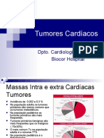 Tumores Cardíacos