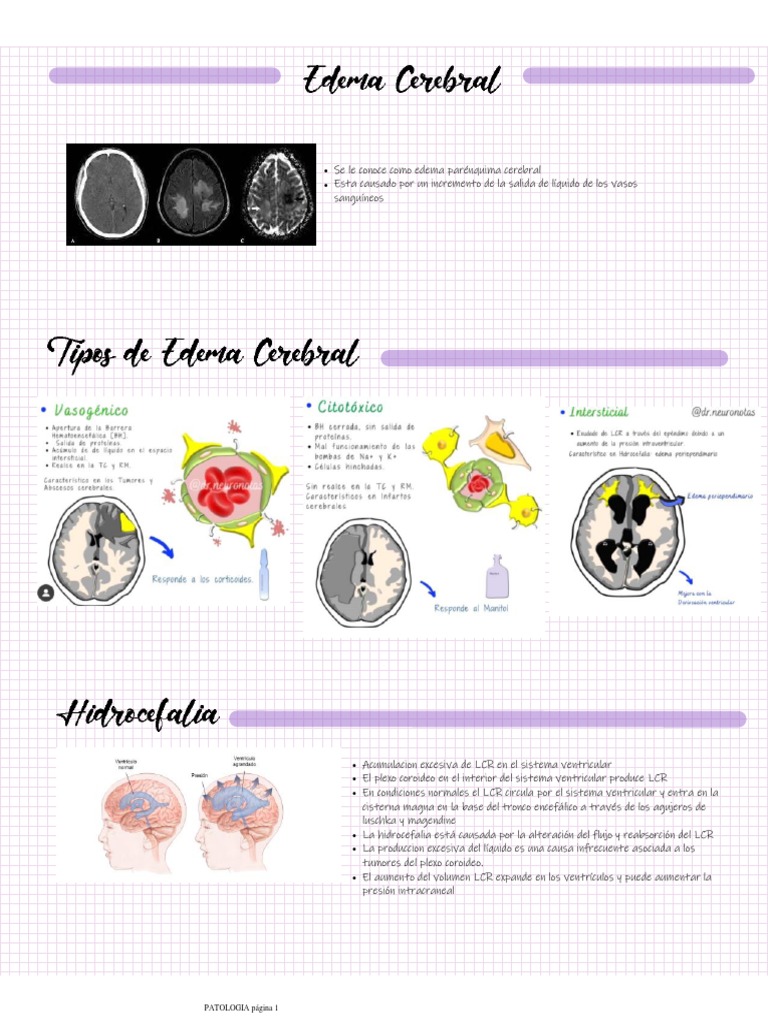 Tipos de edema cerebral y hidrocefalia | PDF | Fluido cerebroespinal ...