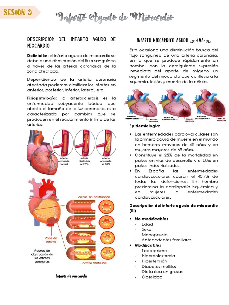 Infarto Agudo Del Miocardio | PDF | Hipertensión | Infarto de miocardio