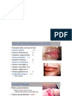 Herpes Simplex Virus Clinical Manifestations and Genital Herpes