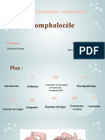 Les Malformations Congénitales: L'omphalocèle