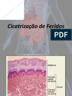 Cicatrização de Feridas