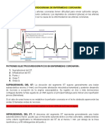 Ekg de Enfermedad Coronaria