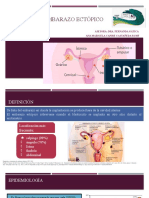 Embarazo ectópico: factores de riesgo, diagnóstico y tratamiento