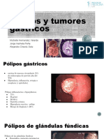 Pólipos y Tumores
