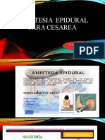 Anestesia Epidural para Cesareas