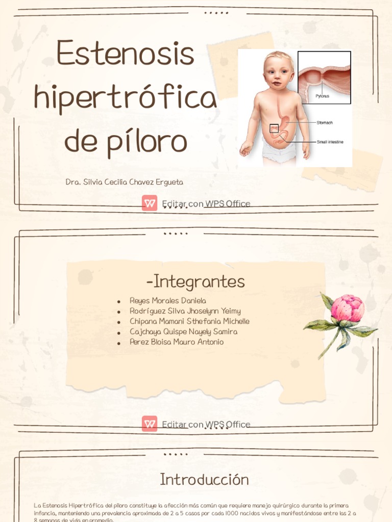Estenosis Hipertrófica del Píloro | PDF | Amamantamiento | Estómago