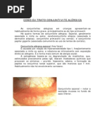 conjuntivite_alergica