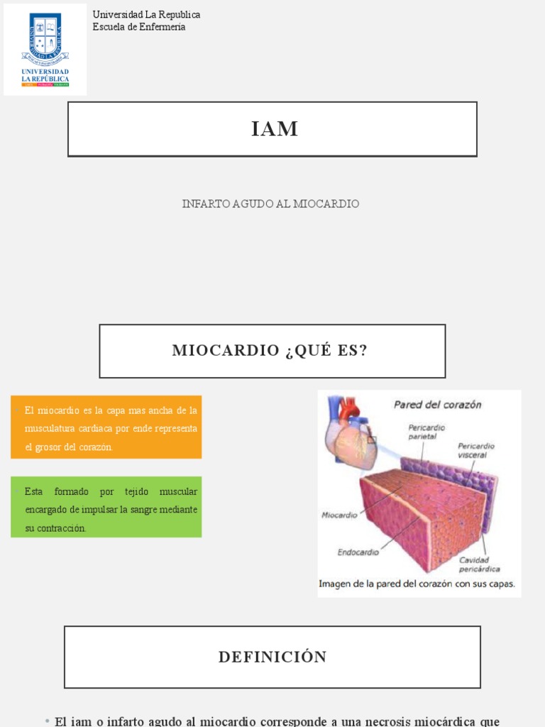 Infarto Agudo Al Miocardio | PDF | Infarto de miocardio | Artería