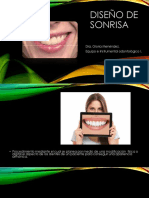 Diseño de Sonrisa