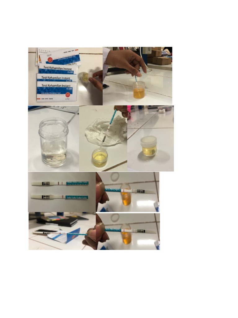 Lampiran Insulin, Urine PDF