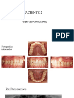 Casos Clinicos Con RX