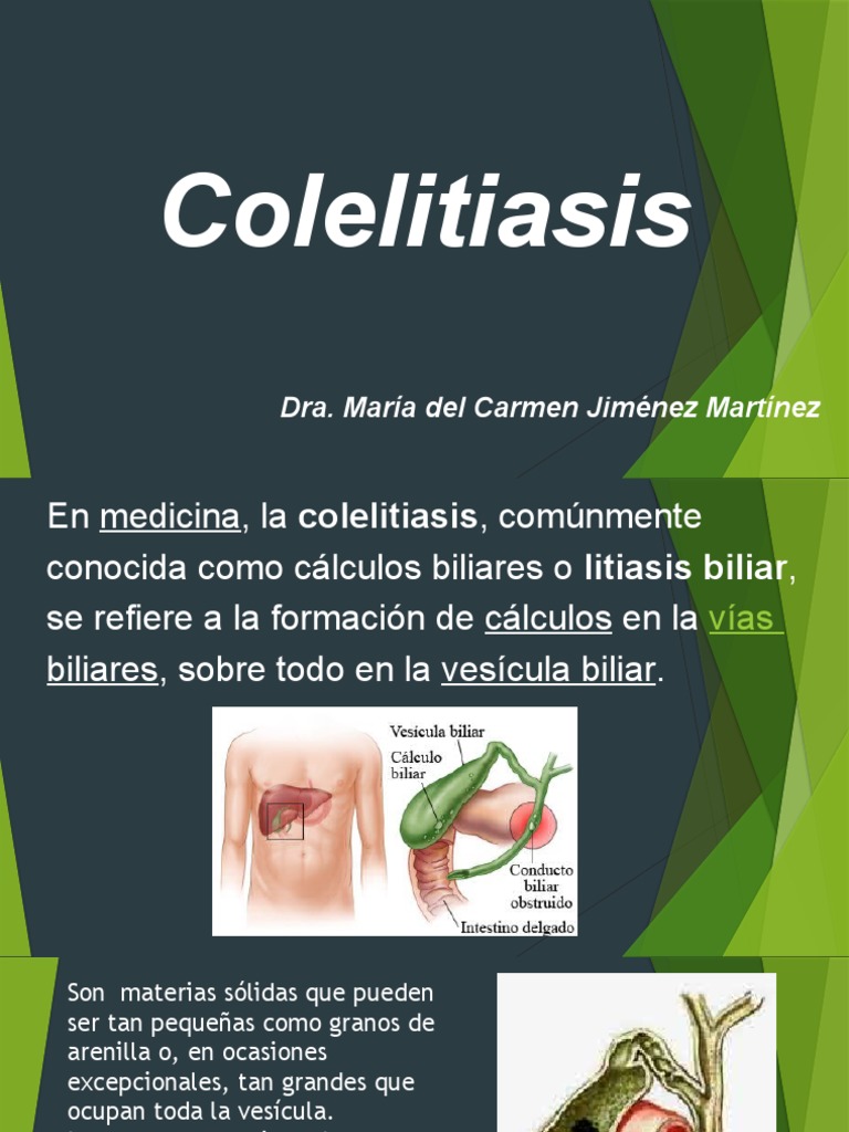 Colelitiasis: Síntomas y Tratamiento | PDF | Epidemiología ...