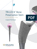 Tri-Lock Bone Preservation Stem: Surgical Technique