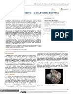 Ovarian Fibrothecoma - A Diagnostic Dilemma: Obstetrics & Gynecology International Journal